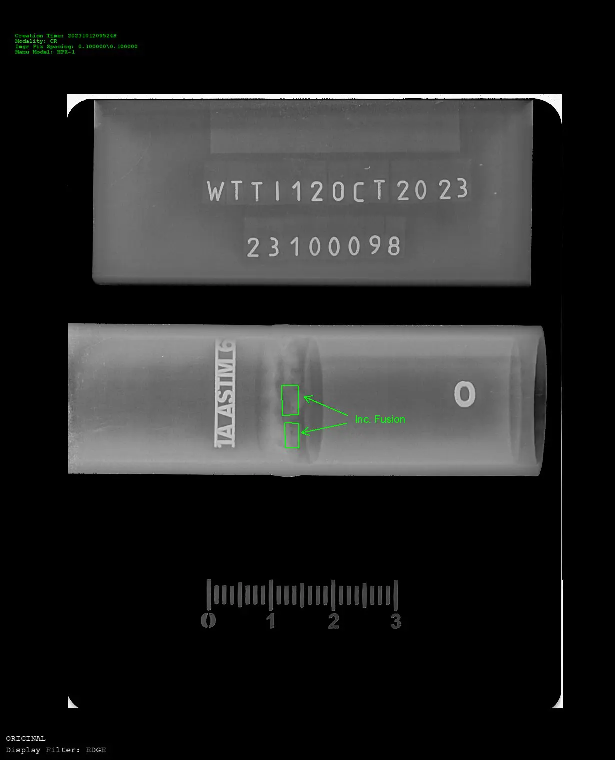 X-ray close up of metal hose