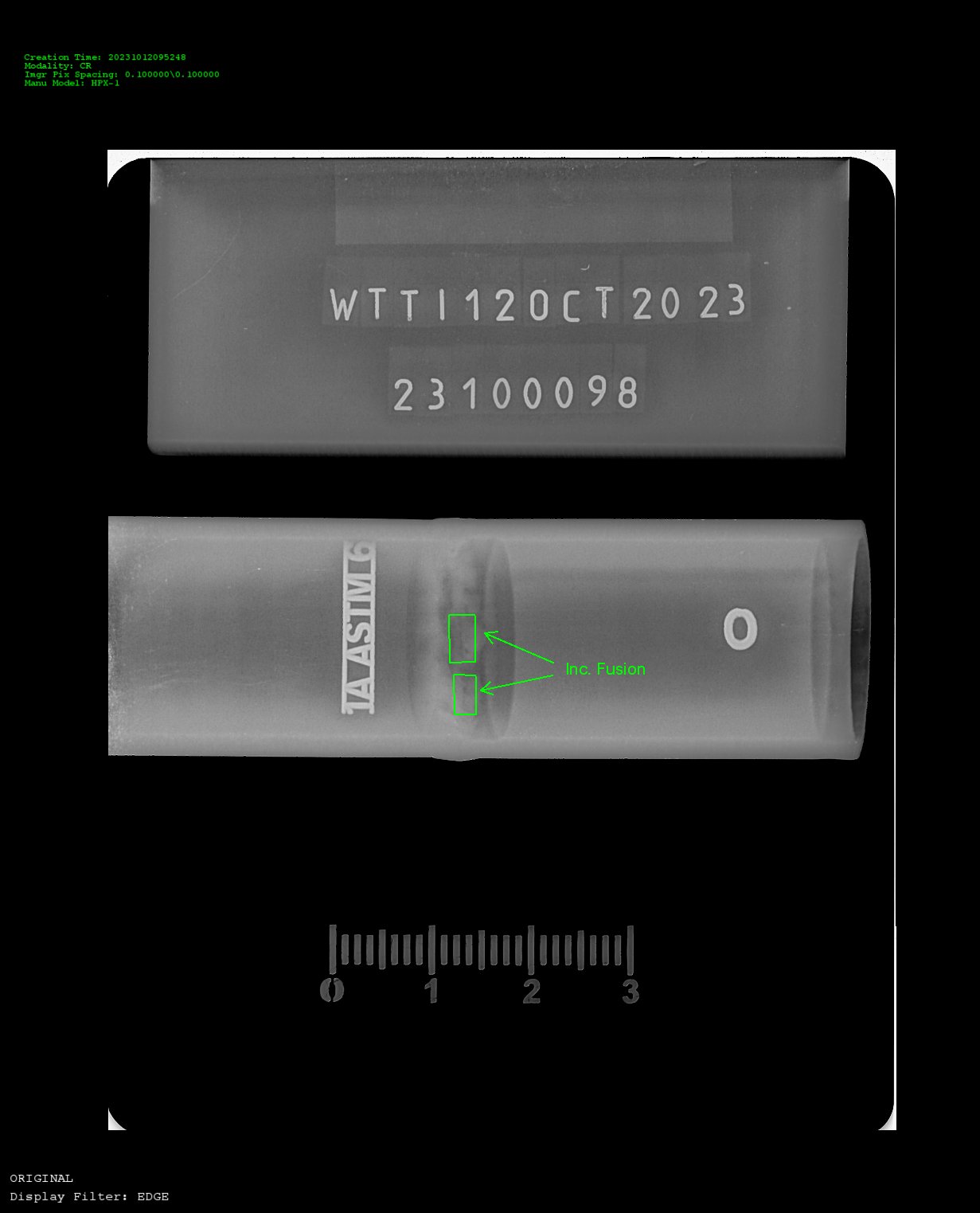 X-ray close up of metal hose